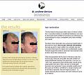 Click image for larger version

Name:	dr.dentonshairclinic.jpg
Views:	553
Size:	152.2 KB
ID:	77665